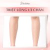 Triệt Lông Nam 1/2 Chân (10 buổi - Bảo hành 5 năm)
