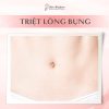 Triệt Lông Bụng (Không giới hạn số buổi - Bảo hành trọn đời)